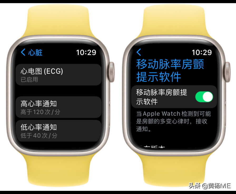 写给妈妈们看的 Apple Watch 功能指南