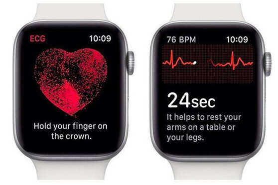 一款很实用的产品,Apple Watch二代,来看看它有什么优缺点吧