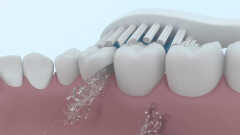 t500电动牙刷正确用法(这样才能避免伤害牙齿)