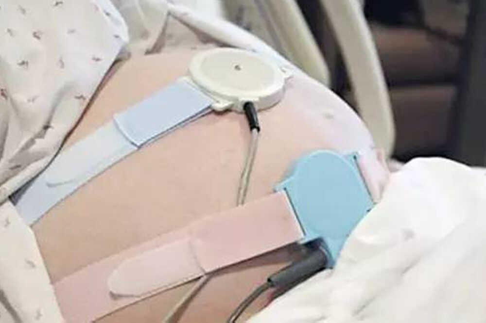 胎心监护图怎么看?这几个数据看懂,自己就能了解胎儿的健康情况