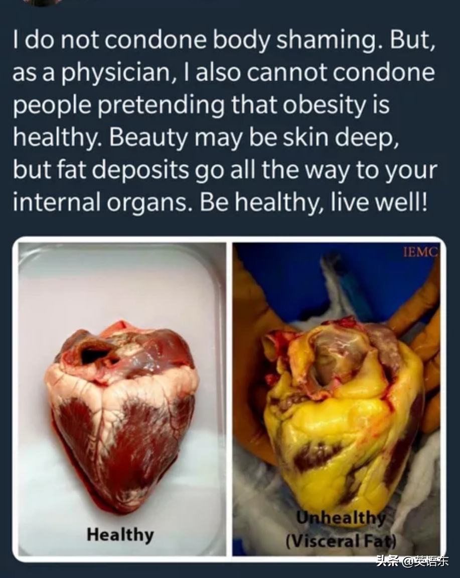 看图学英文   obesity