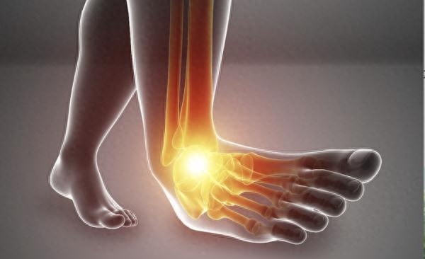 崴脚处理不当可能导致终身残疾!1分钟帮你自测崴脚风险