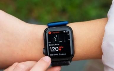智能手表竟然能救命 为了这几样功能也得买